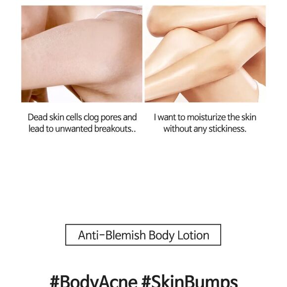 TIA'M, Anti Blemish Body Lotion Back & Chest 200ml - Picture 3 of 12